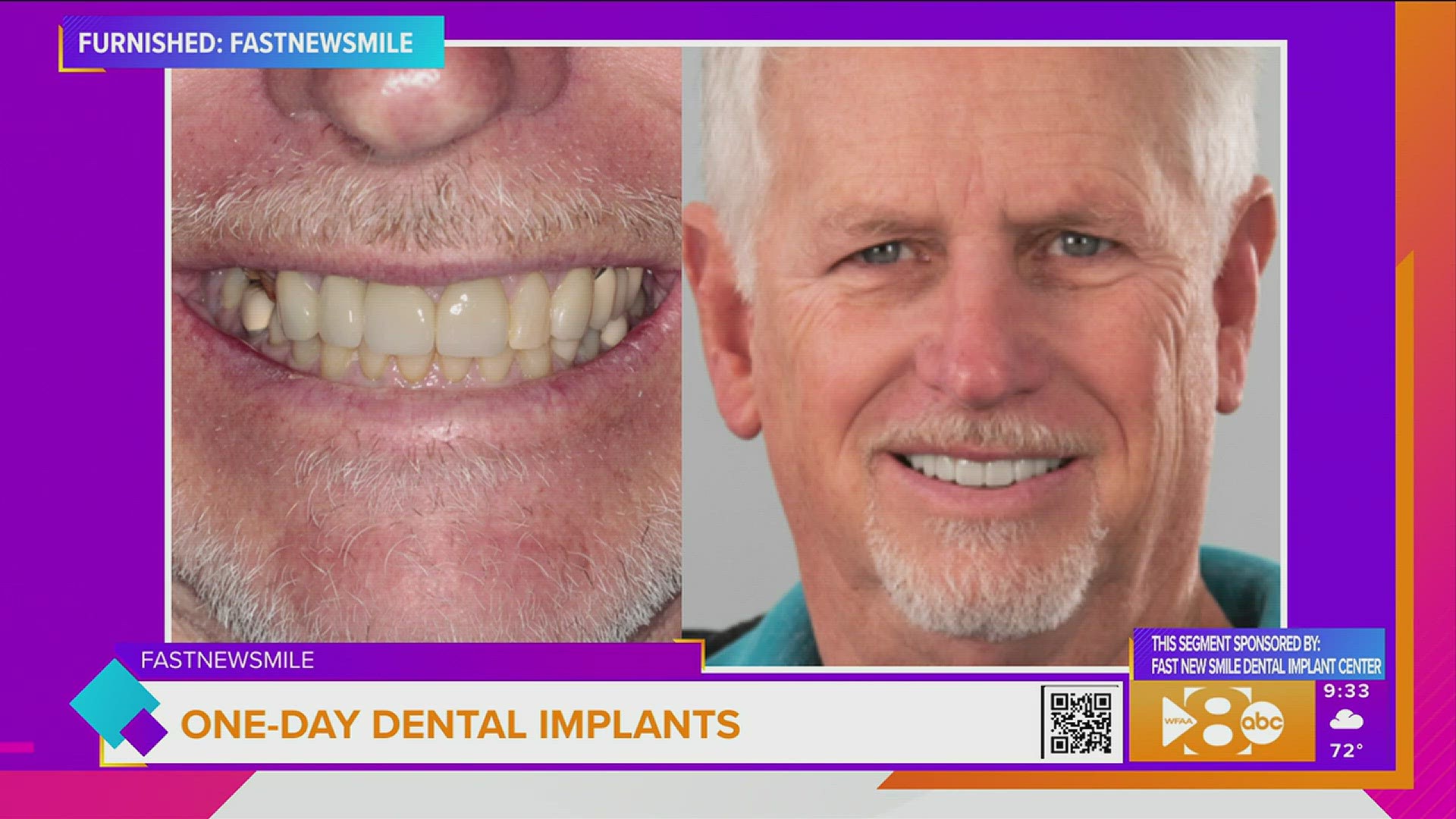 This segment is sponsored by: Fast New Smile Dental Implant Center