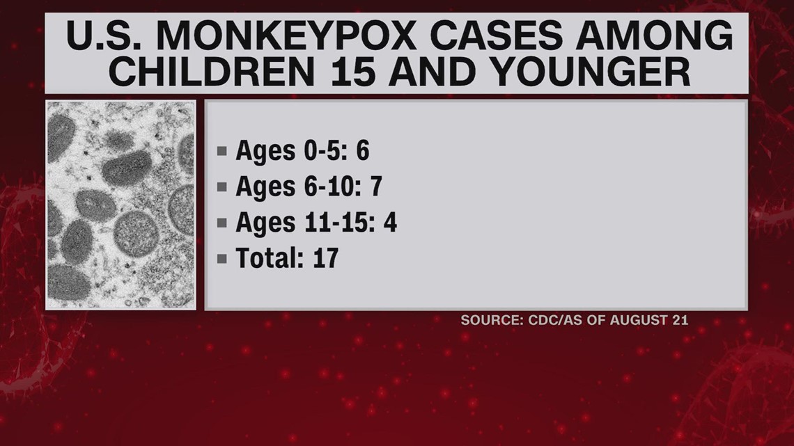 Schools on alert for monkeypox