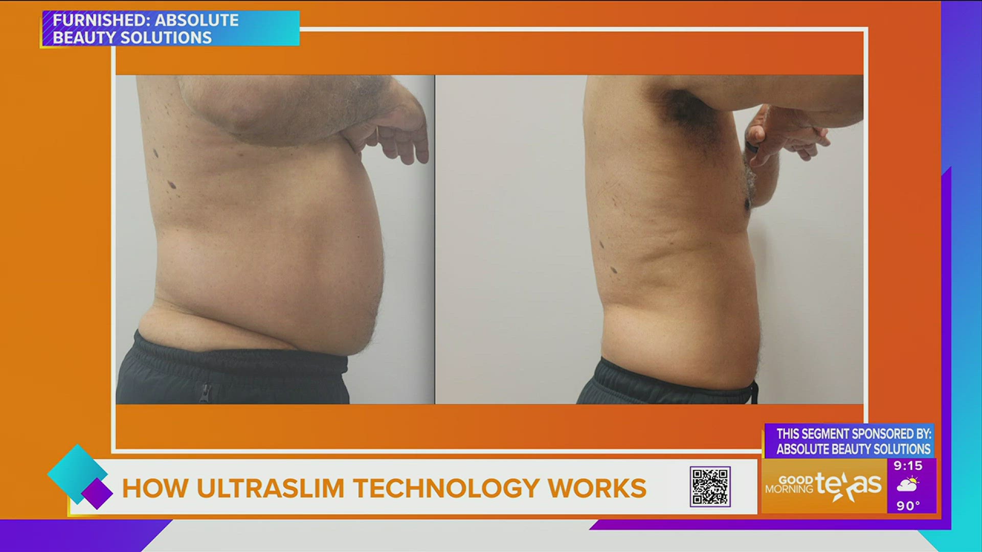Sponsored How UltraSlim Technology Works at Absolute Beauty Solutions