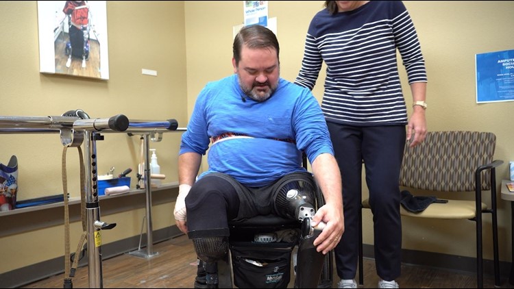 Cape Coral company offers prosthetic legs to double amputee