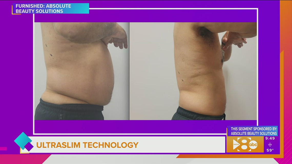 Absolute Beauty Solutions Wants to Help you Take Inches Off