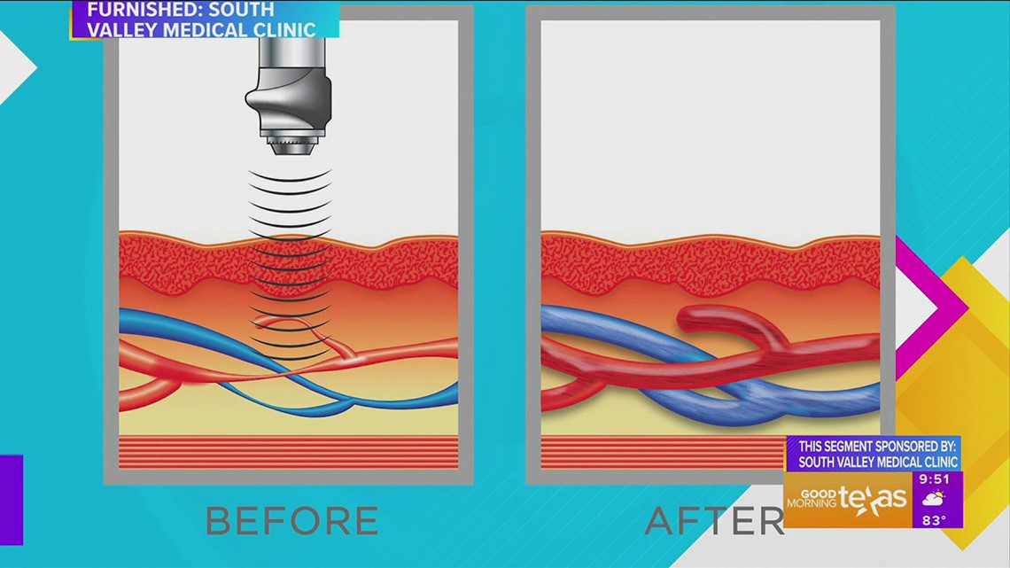 South Valley Medical Clinic's approach to treating erectile dysfunction