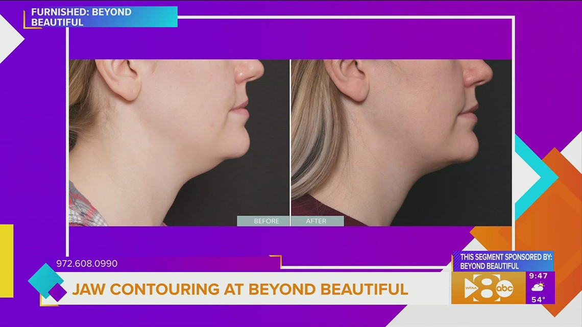 Jaw Contouring at Beyond Beautiful