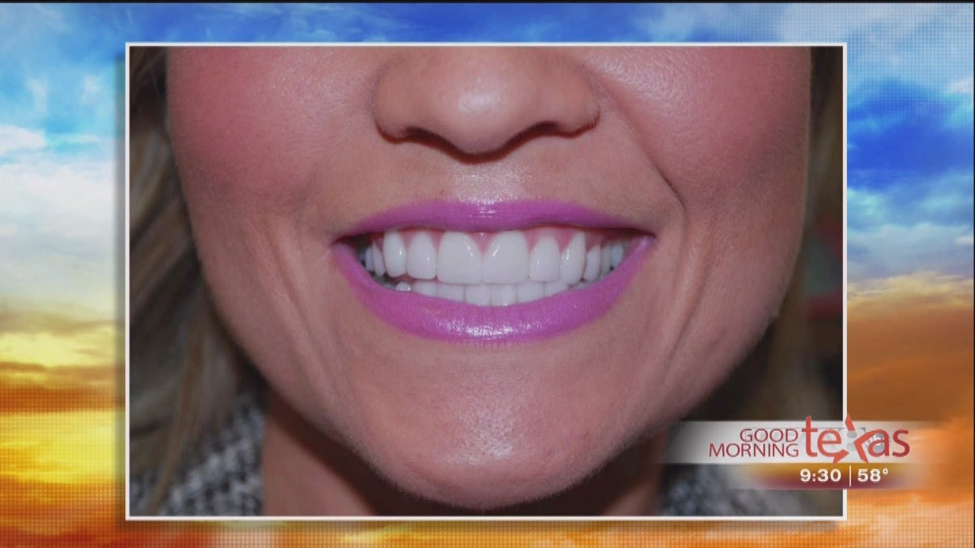 Transforming Your Smile with MINT Dentistry