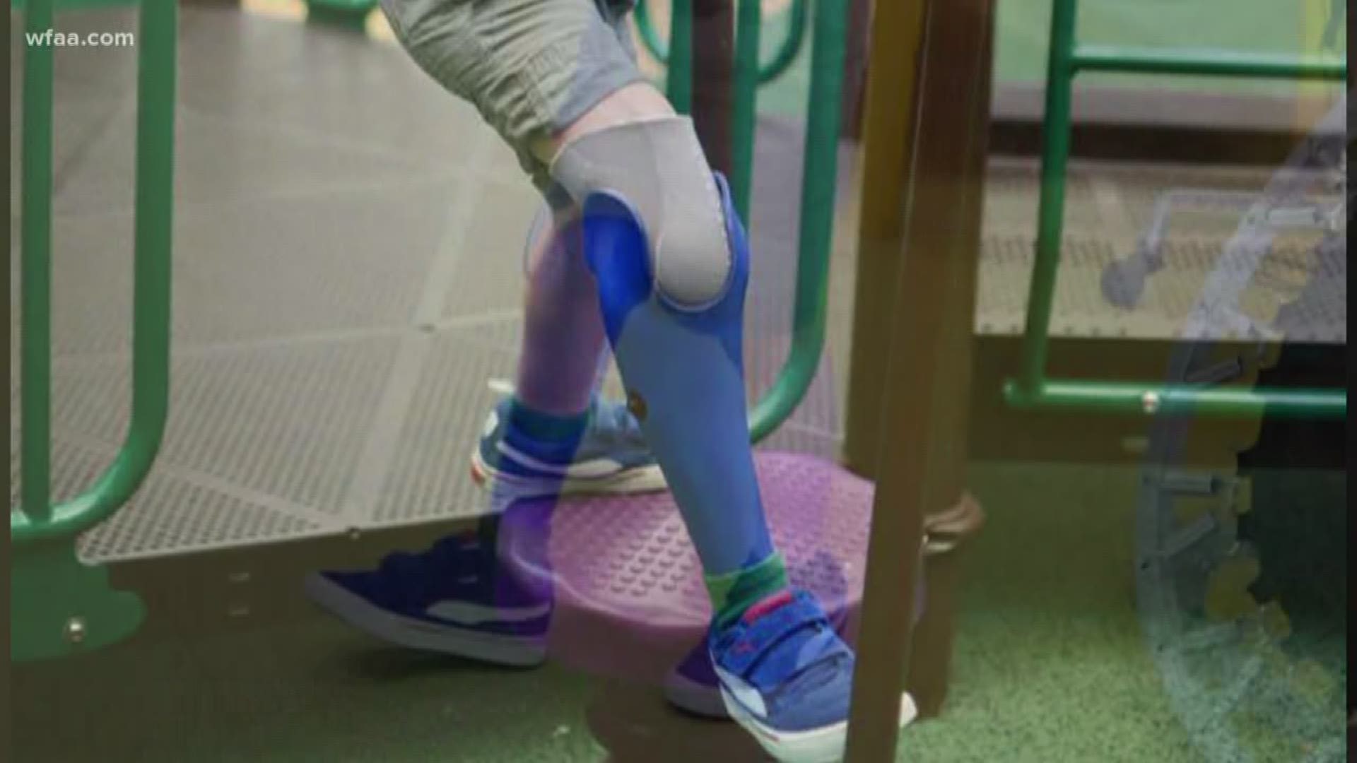 Scottish Rite Hospital for Children creating custom limbs for those in need