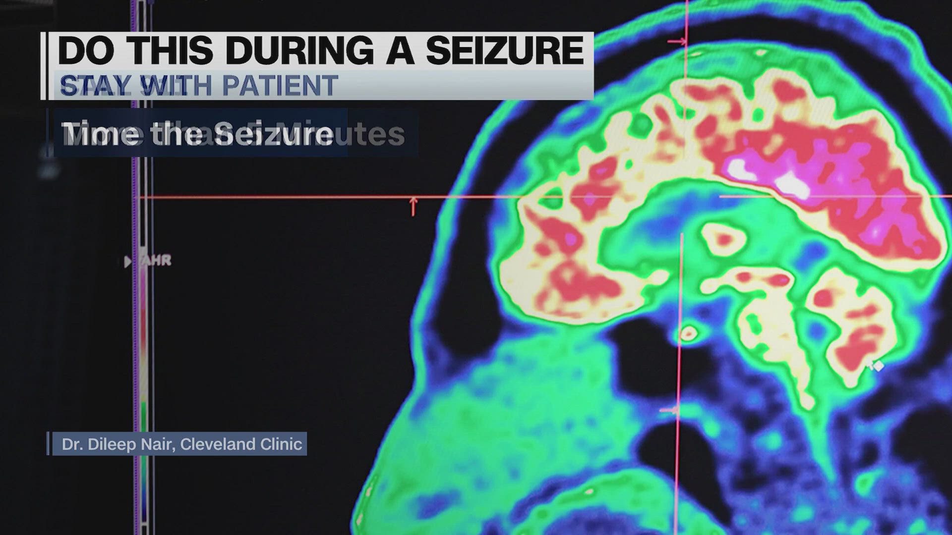 Here's what to do if someone experiences a seizure.