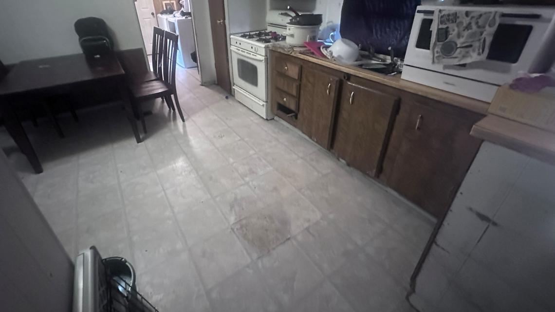 Tarrant County investigates toddler's severe burns from sulfuric acid accident