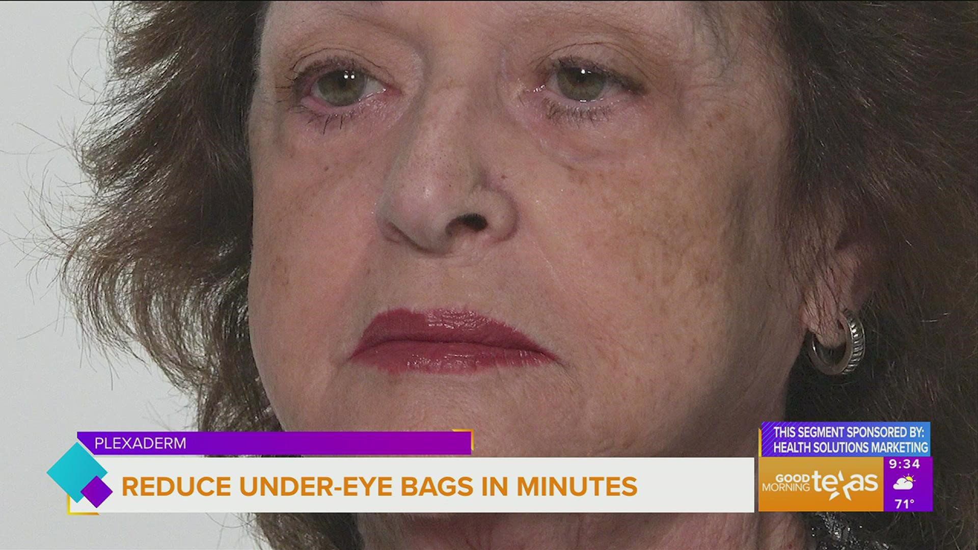 reduce-under-eye-bags-in-minutes-with-plexaderm-wfaa