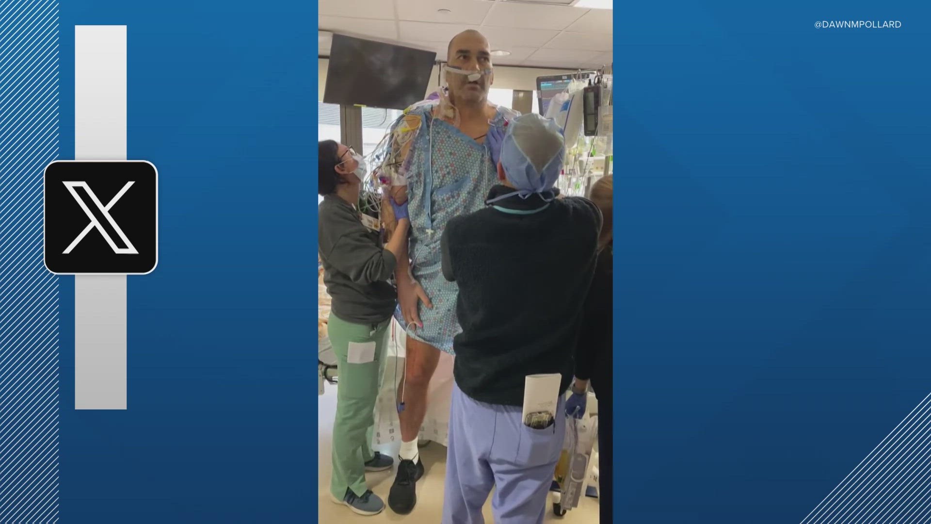 Former Indiana Pacer Scot Pollard gets heart transplant | wfaa.com