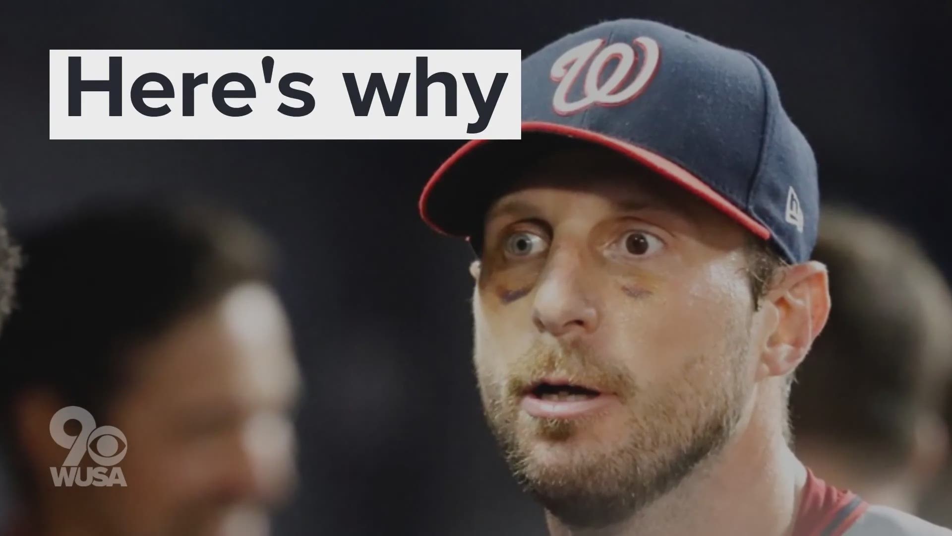 The Nationals starting pitcher has a condition known as heterochromia iridis.